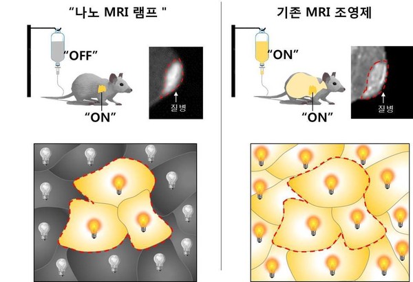 나노 MRI 램프는 꺼진 상태였다가 특정 생체인자를 만나면 켜진다.(왼쪽) 질병 조직만 선택적으로 밝게 촬영할 수 있다. 기존 MRI 조영제는 항상 신호가 켜져 있어 병변 부위와 정상 조직 사이의 구분이 어렵다.(오른쪽) 나노의학연구단 제공. 출처: 병든 세포만 찍는 ‘족집게 MRI 램프’ 개발, 한겨레, 2017-02-07.